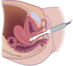 anteverted uterus imaging