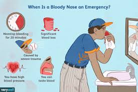When A Bloody Nose Becomes An Emergency