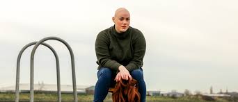 alopecia advocate laura mathias