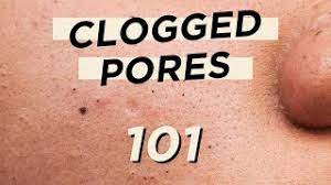 clogged pores skincare