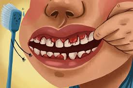 why do my gums bleed dental wellness