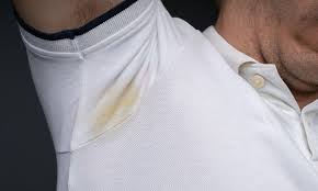 get yellow stains out of white shirts