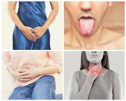 can candida affect the thyroid dr