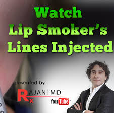 injecting dermal filler to correct lip