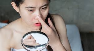 pimple inside nose tips on how to