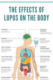affected organ in lupus nephritis