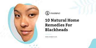 10 natural home remes for blackheads