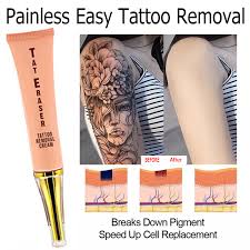 local delivery tateraser tattoo removal