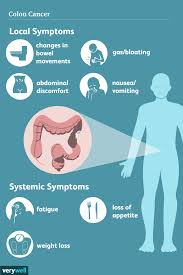 colon cancer symptoms signs and