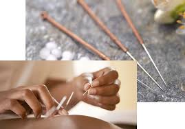 450 hours of the required 1,800 hours of training must be in herbal training. Dfw Acupuncture Center
