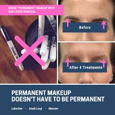 permanent makeup removal munster