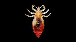 body lice infestation causes symptoms