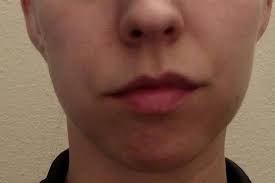 fix asymmetry of mouth photos