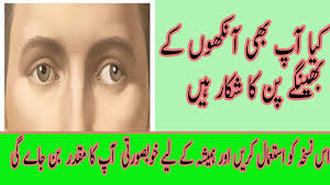 I was down to the final straw when i figured out how to naturally fix my lazy eye without patching, glasses or surgery. How To Fix Your Lazy Eye In Urdu By Maan Health Care How Can I Fix