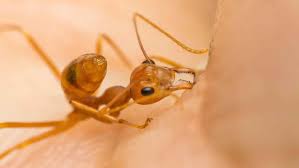 ant bites stings symptoms diagnosis