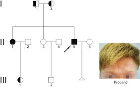 Oncotarget Mutational Analysis Of A Chinese Family With