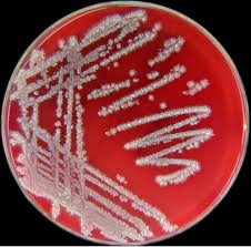 Bacillus Licheniformis Wikipedia