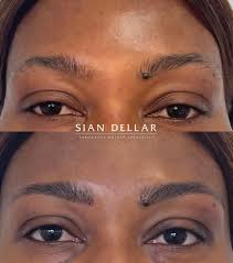 taming unruly brows with microblading