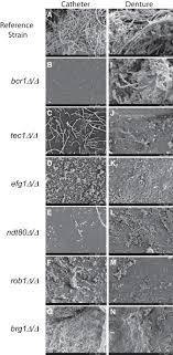 Bio Development In Candida Albicans