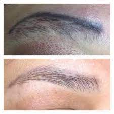 permanent makeup removal diane s