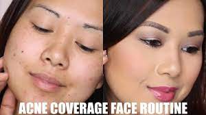 acne dark spot coverage routine