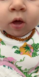 bottom lip purpleish bruise babycenter