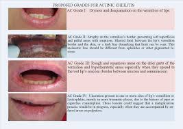 actinic cheilitis proposition and