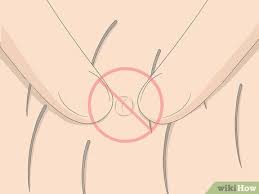 Deep hair cyst on your big bumps on inner thigh might be boils or furuncles that develop due to infection of hair follicle. How To Get Rid Of Ingrown Pubic Hair With Pictures Wikihow