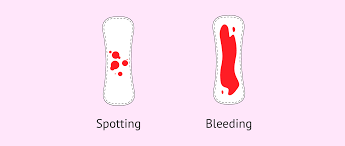 is bleeding in pregnancy normal what