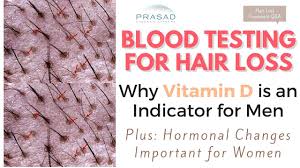 testing for hair loss importance of