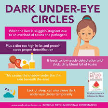 dark under eye circles