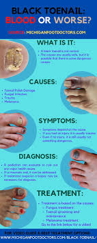 black toenail treatment causes