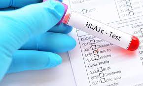 frequently asked questions hba1c test
