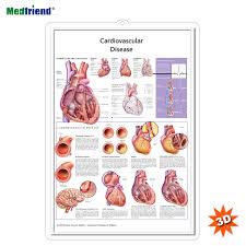 Licensed Educational Plastic 3d Medical Anatomical Wall Chart Poster Cardiovascular Disease Buy Medical Paper 3d Pvc Chart Cardiovascular