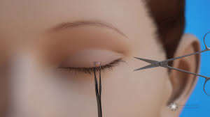 remove lesions from the eyelid