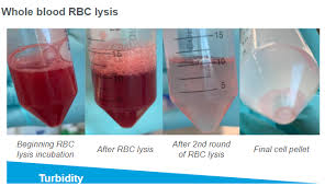 how do i know my rbc lysis is working