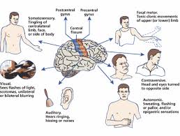 Types Of Seizures Chart Types Of Seizures Types Of