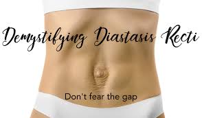 7 myths about diastasis recti our