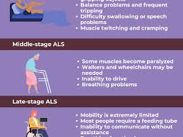 ses of amyotrophic lateral sclerosis