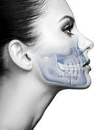 numbness after orthognathic surgery