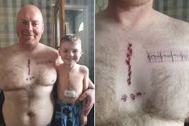 A big feather with four small birds taking flight would be a sweet tattoo idea for your late dad. Proud Dad S Heartwarming Tattoo Of Son S Scar After Life Saving Open Heart Surgery Uk News Newslocker