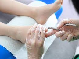 painful ingrown toenail treatment singapore