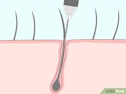 Your armpits are a sensitive area, so choose the hair removal method that feels most comfortable to you. 5 Ways To Remove Armpit Hair Wikihow