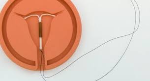 do copper iud users experience weight gain