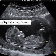 Image result for justin-bieber-hailey-baldwin-pregnant-april-fools-day