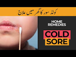 cold sore home remes hash