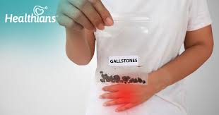 best foods to eat after gallbladder surgery