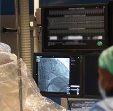 Mount Sinai Brings Epiaccess System For Cardiac Arrhythmias