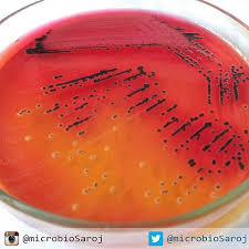 On the other hand, the appearance of colonies on chromogenic agar were variable in size convex and mauve in color as shown in (figure 1, d). Xyloselysinedeoxychloateagar Instagram Posts Photos And Videos Picuki Com