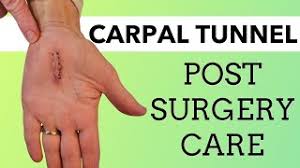 carpal tunnel post surgery care